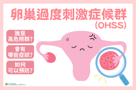什么是 OHSS？卵巢过度刺激风险与预防 - 安维纳ANVINO